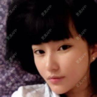 更美 - エイリ的全切双眼皮经验 | 全切双眼皮 | 埋线双眼皮 | 开外眼角 | 内切去眼袋 | 自体脂肪填充泪沟 | 切眉 | 自体脂肪淡化黑眼圈 | 除皱瘦脸 | 自体脂肪丰苹果肌 | 自体脂肪垫下巴 | 硅胶垫下巴 | 酒窝成形 | 自体脂肪丰面颊 | 自体脂肪丰额头 | 光子嫩肤 | 假体隆胸 | 硅胶隆鼻 | 厦门