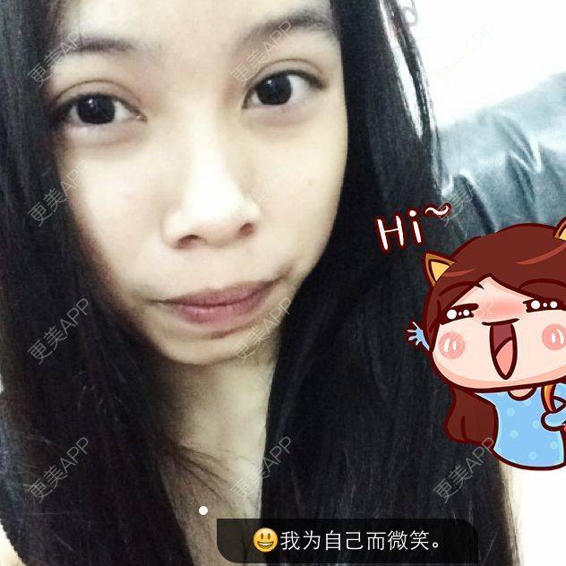 更美 - ?忘我，你敢么?的经验 | 牙齿 | 热门讨论