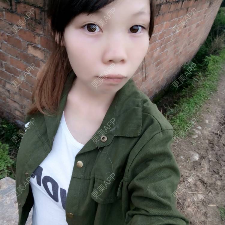 更美 - 更美用户92087073的经验 | 隆鼻 | 怀化