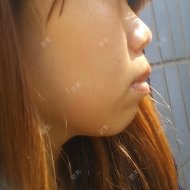 口腔其他
