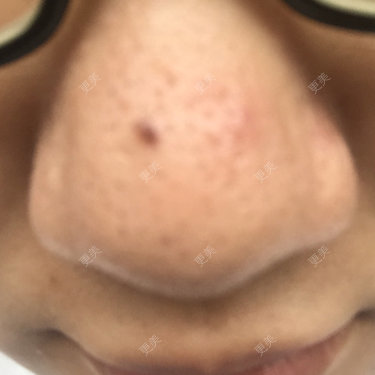 更美用户28747179