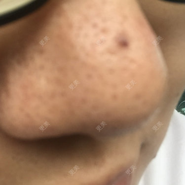 更美用户28747179