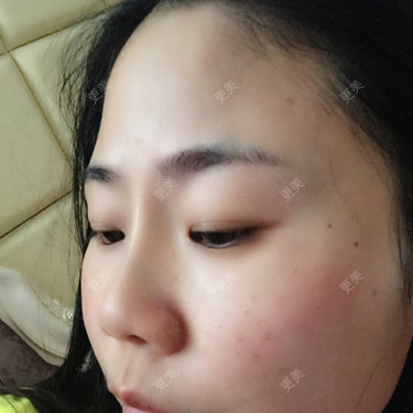 额头中间突出两侧凹陷感觉像寿星的额头真的很羡慕那些额头宽的饱满的