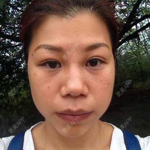 没有丑女人的硅胶垫下巴日记