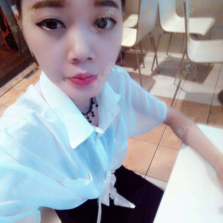 更美 - 畫面太美，不敢看 °的经验 | 隆鼻 | 广安