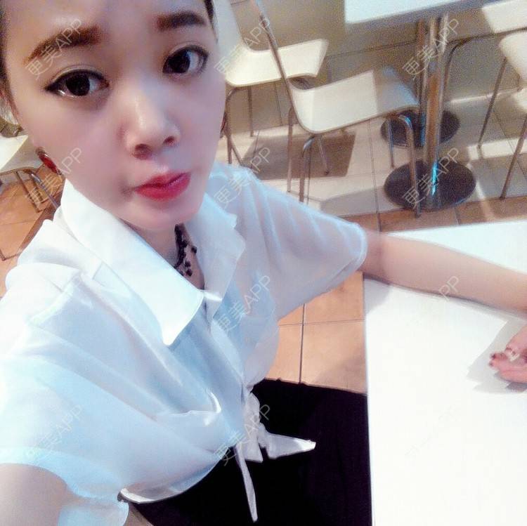 更美 - 畫面太美，不敢看 °的经验 | 隆鼻 | 广安