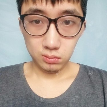 轮廓修复