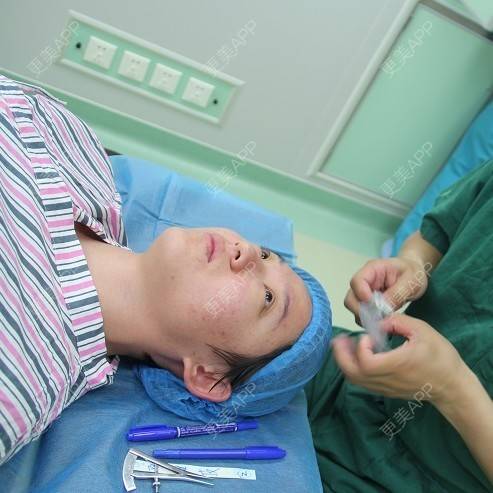 更美 - 切开双眼皮 | 黑脸娃娃 | 深圳