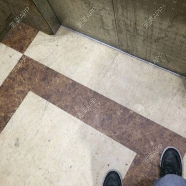 更美 - 切开双眼皮的日记 | 黑脸娃娃 | 深圳