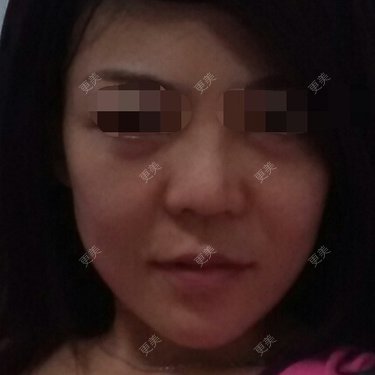 轮廓修复