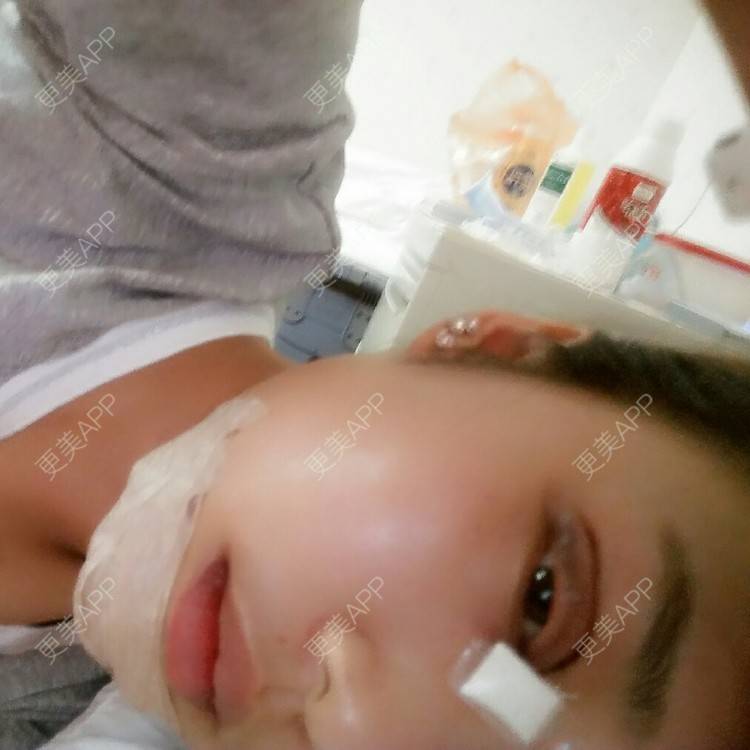 更美 - 切开双眼皮+开内眼角+硅胶垫下巴+瘦脸针 | 激光洗纹身 | 产后塑形 | 下颌角 | 黑脸娃娃 | 赣州