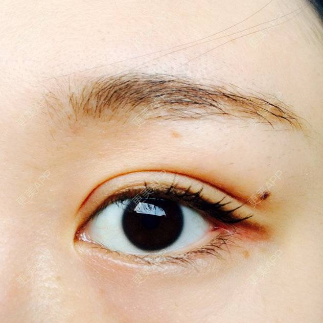 gakkii的全切双眼皮日记