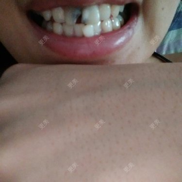 更美用户92493049