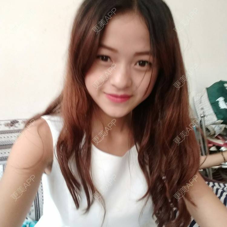更美 - 更美用户54784180的经验 | 鼻部修复 | 东莞