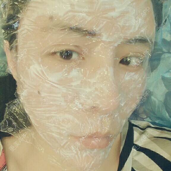 更美 - 水萌儿的自体脂肪垫下巴经验 | 自体脂肪填充泪沟 | 自体脂肪垫鼻基底 | 自体脂肪丰面颊 | 自体脂肪丰太阳穴 | 自体脂肪丰额头 | 全切双眼皮 | 自体脂肪丰苹果肌 | 自体脂肪垫下巴 | 南充