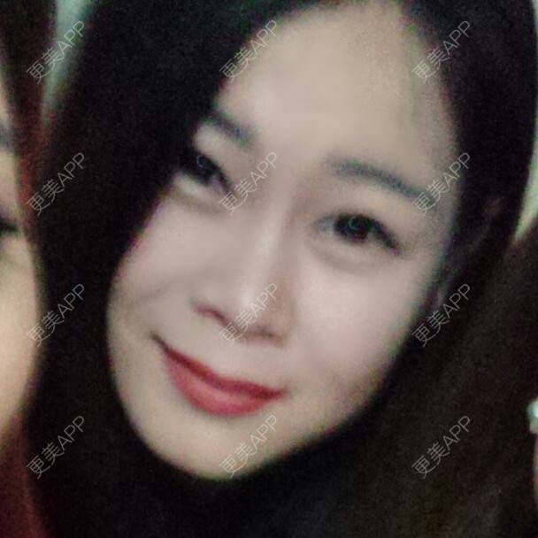 更美 - ⣗你能控制心它不动吗？的鼻翼缩小经验 | 鼻翼缩小 | 我要高鼻梁