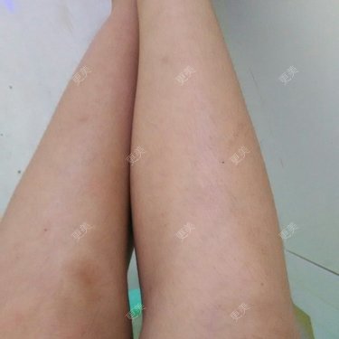 更美用户49282978
