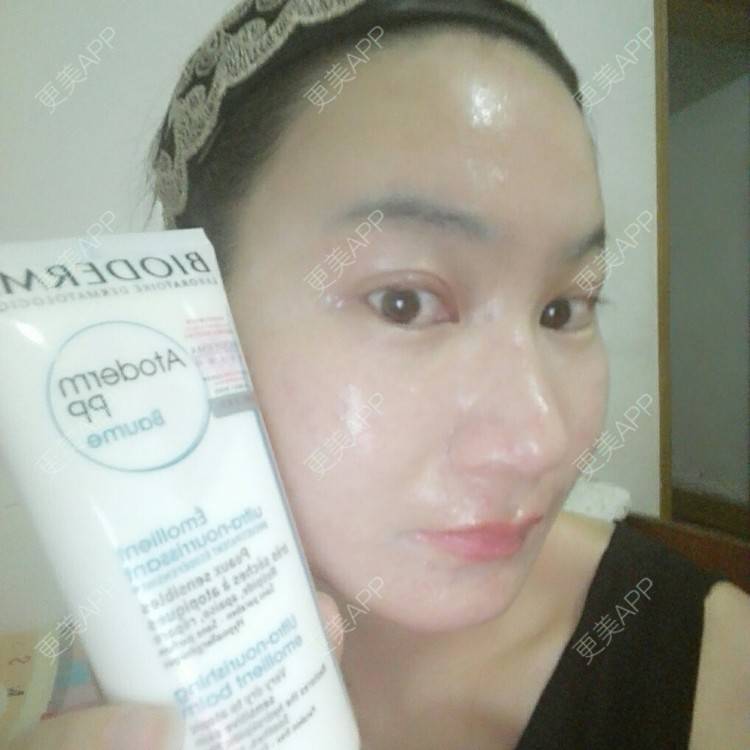 更美 - 更美用户27416885的激光淡化红血丝经验 | 果酸焕肤 | 红蓝光清痘 | 激光淡化红血丝 | 上海