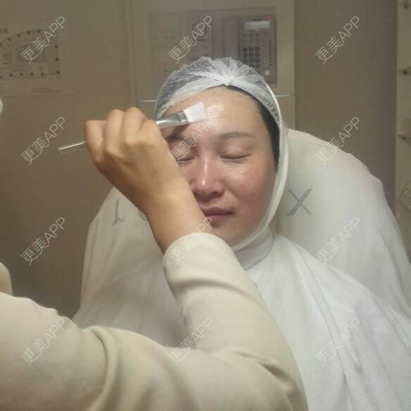 更美 - 更美用户27416885的激光淡化红血丝经验 | 果酸焕肤 | 红蓝光清痘 | 激光淡化红血丝 | 上海