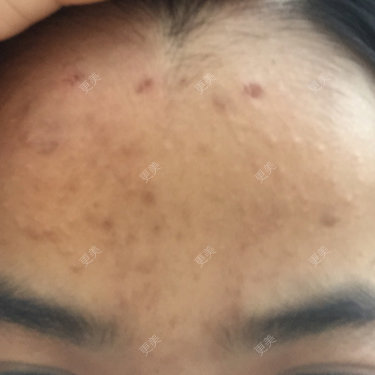 更美用户80572856