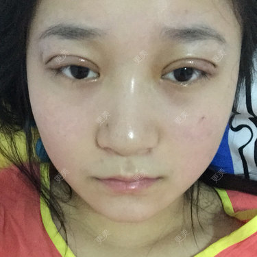 呆子。