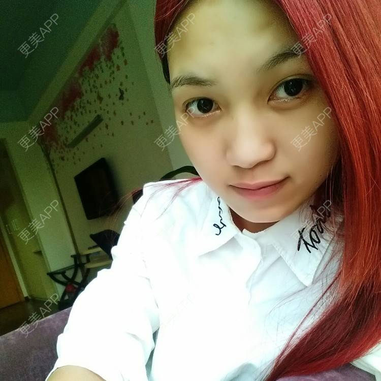 更美 - 柠  檬  酸的经验 | 唇形