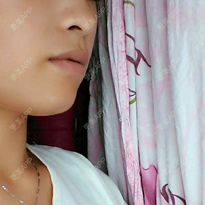 更美 - 更美一直美美的的牙齿矫正经验 | 龅牙 | 牙列拥挤 | 拔牙 | 牙齿矫正 | 蛀牙 | 孝感