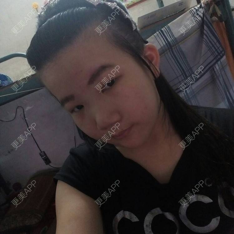 更美 - 更美用户92948131的经验 | 妊娠纹 | 防城港