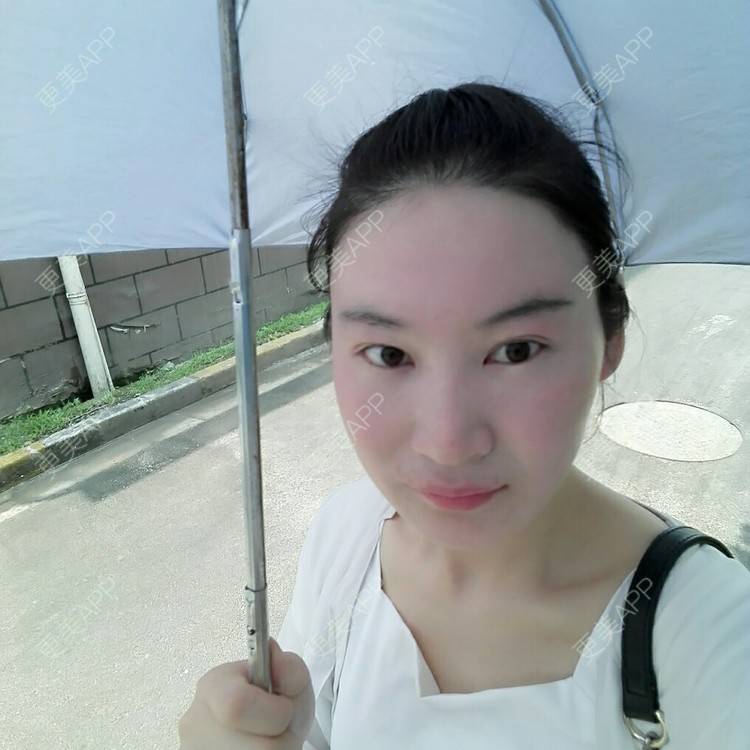 更美 - 更美用户27416885的激光淡化红血丝经验 | 果酸焕肤 | 红蓝光清痘 | 激光淡化红血丝 | 上海