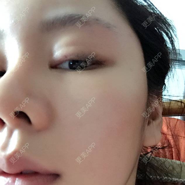 更美 - ✖。的经验 | 额头 | 朝阳