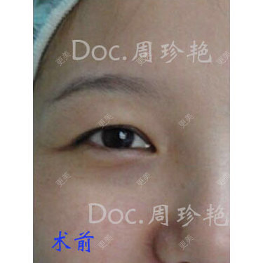 周珍艳 医生