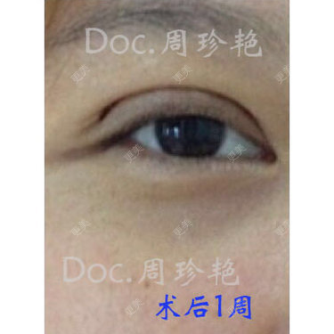 周珍艳 医生