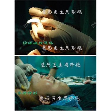 周珍艳 医生