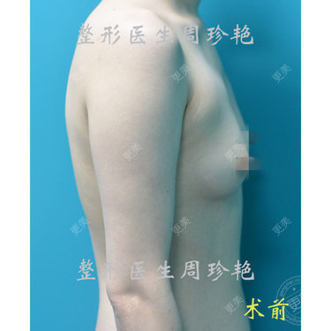 周珍艳 医生