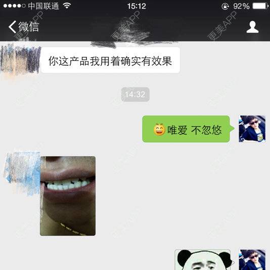 更美 - 蓝色夏威夷的经验 | 冷光美白 | 美白牙齿 | 唯爱牙齿冷光美白仪 | 北京