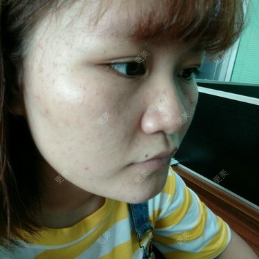小小小夏_瘦瘦瘦瘦