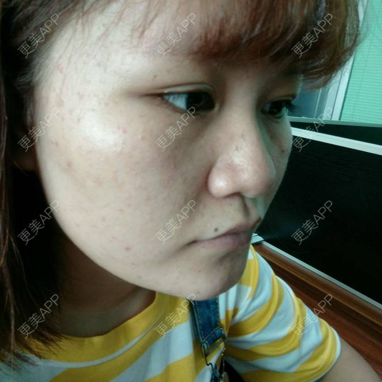 更美 - 小小小夏_瘦瘦瘦瘦的经验 | 注射美容 | 东莞