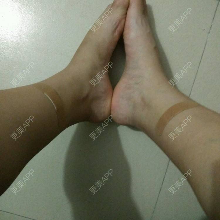 更美 - 小小小夏_瘦瘦瘦瘦的经验 | 东莞