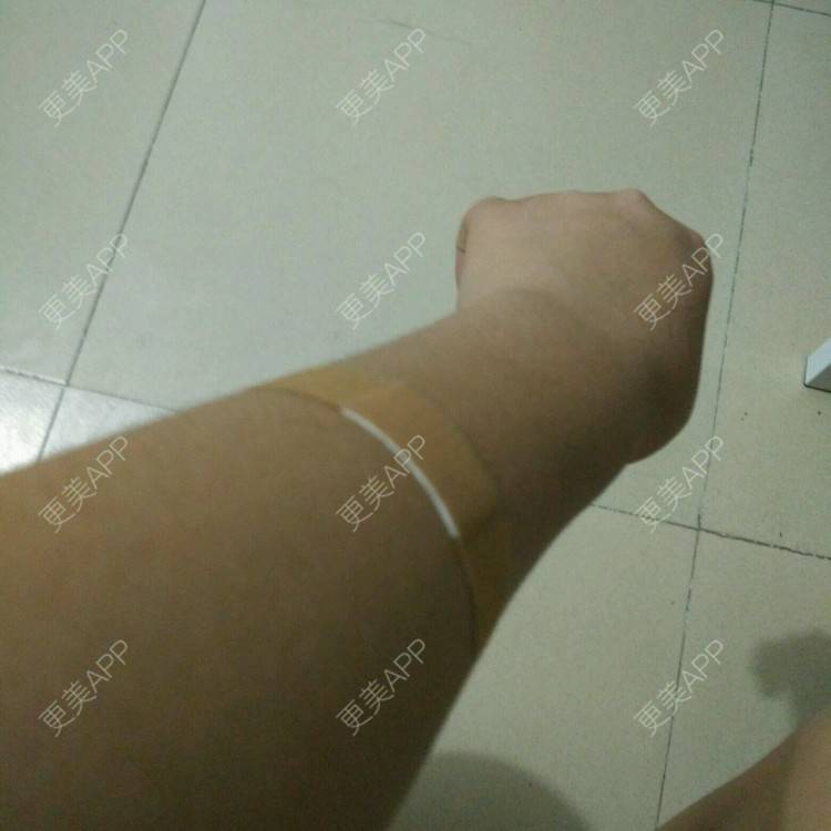 更美 - 小小小夏_瘦瘦瘦瘦的经验 | 东莞