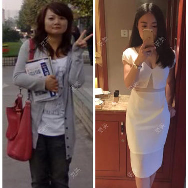 杨慢慢忽胖忽瘦不成形儿