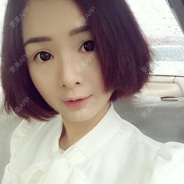 更美 - 安町的经验 | 送瘦脸针 | 北京