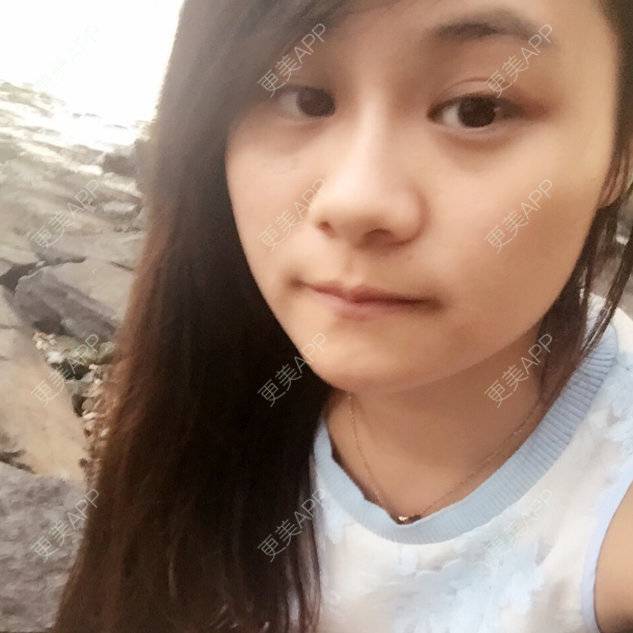 更美 - 黑色不离，白色不弃的经验 | 去黑眼圈去眼袋 | 九江