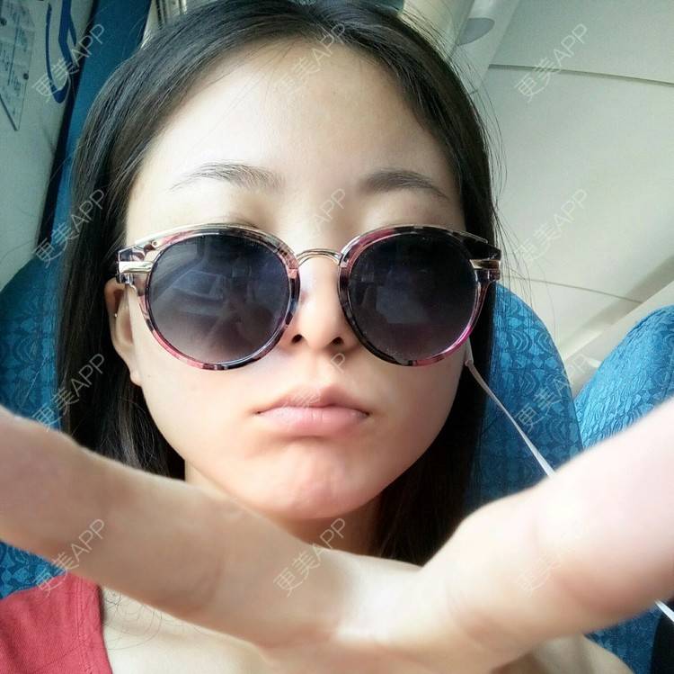 更美 - YC-607 红包减肥群的经验 | 送瘦脸针 | 邯郸