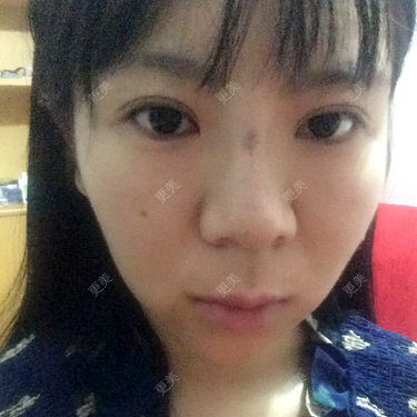 顶天立地的鸵鸟_