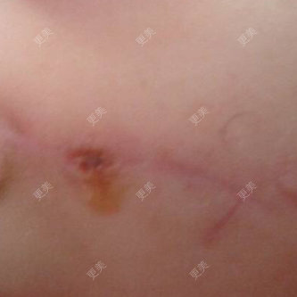 更美用户4048125580
