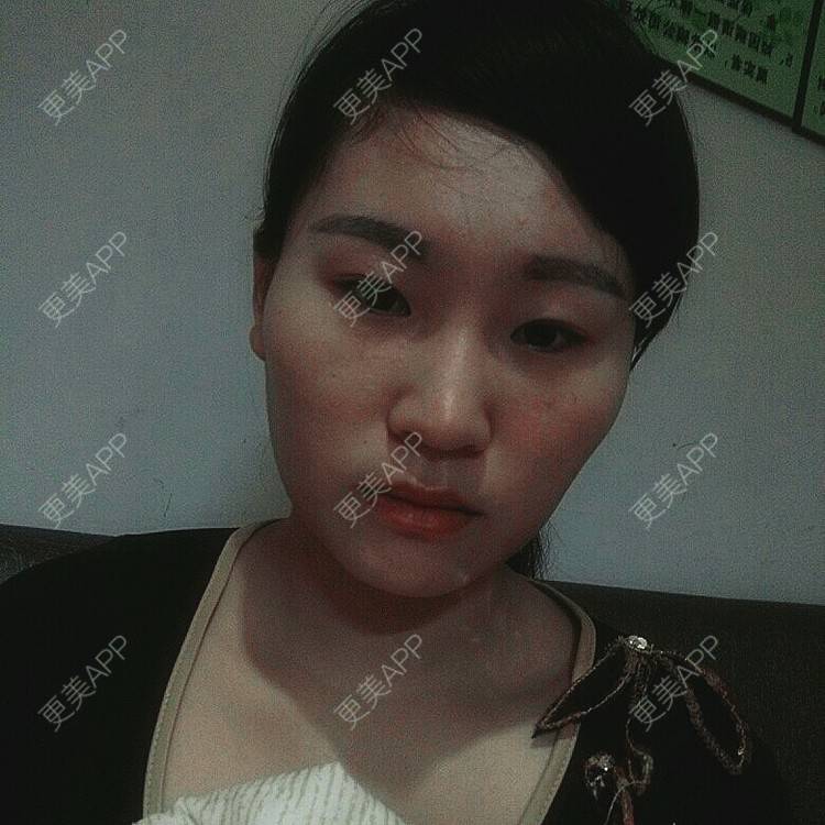 更美 - 随遇而安︶的经验 | 颧骨颧弓 | 佛山