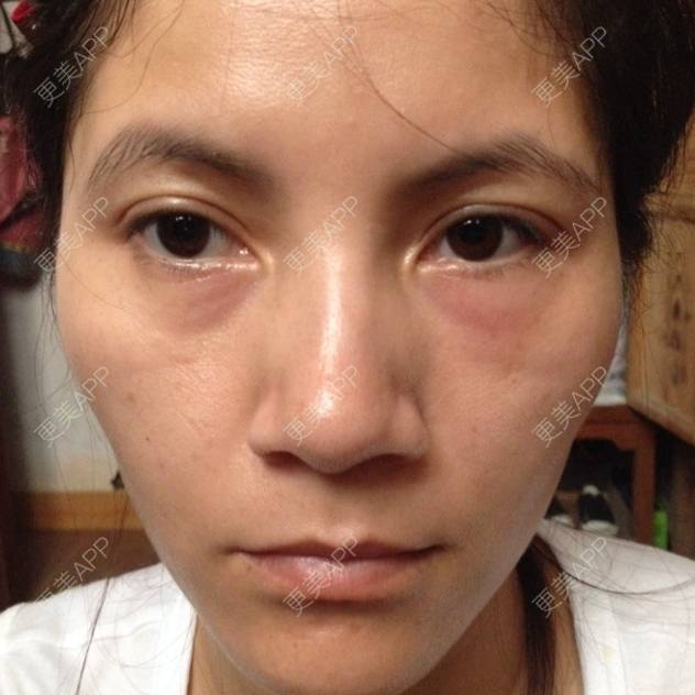 更美 - vip6881688的经验 | 祛眼袋 | 江门