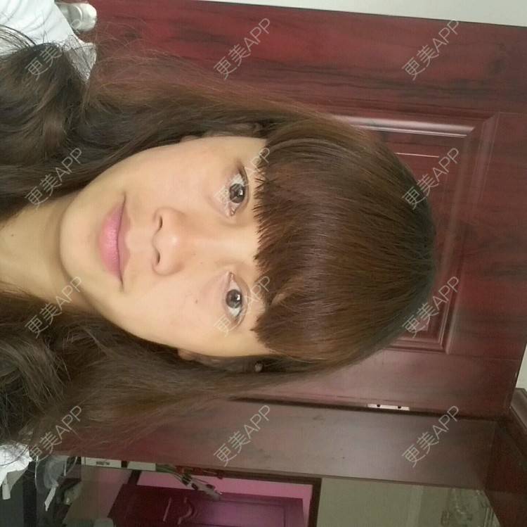 更美 - 18*******14的经验 | 你看我整哪 | 免费除皱纹
