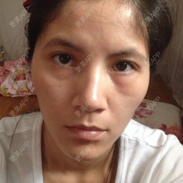 更美 - vip6881688的经验 | 祛眼袋 | 江门