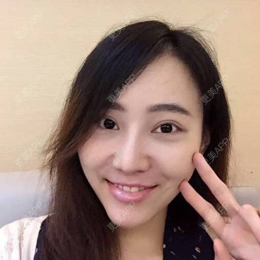 更美 - ゛蒣尐潔。的经验 | 免费除皱纹 | 广州